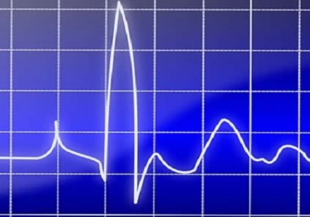 New Mathematical Model Helps Digitalise Heart Rhythms