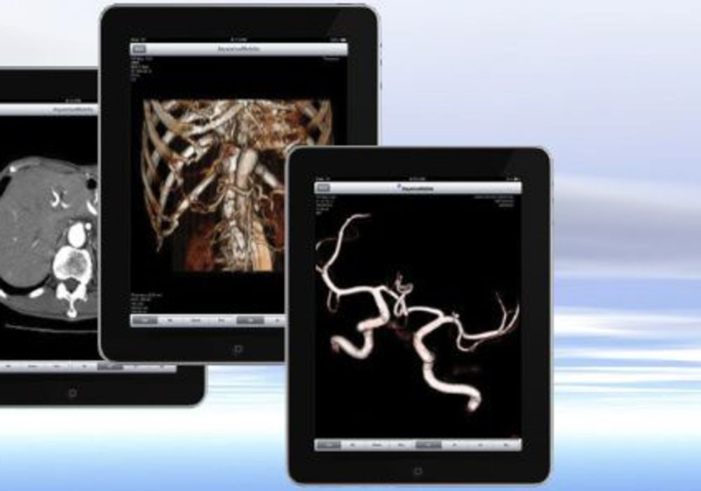 #ECR2015: TeraRecon Demonstrates Advanced Enterprise Image Enablement 