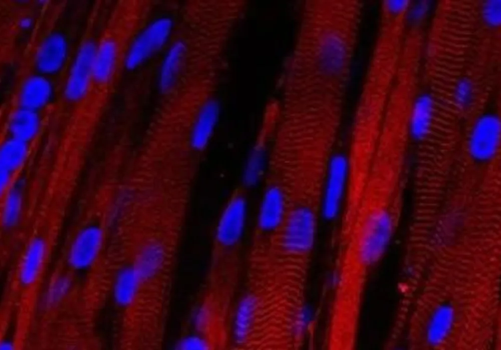 Researchers Grow First Contracting Human Muscle in Laboratory
