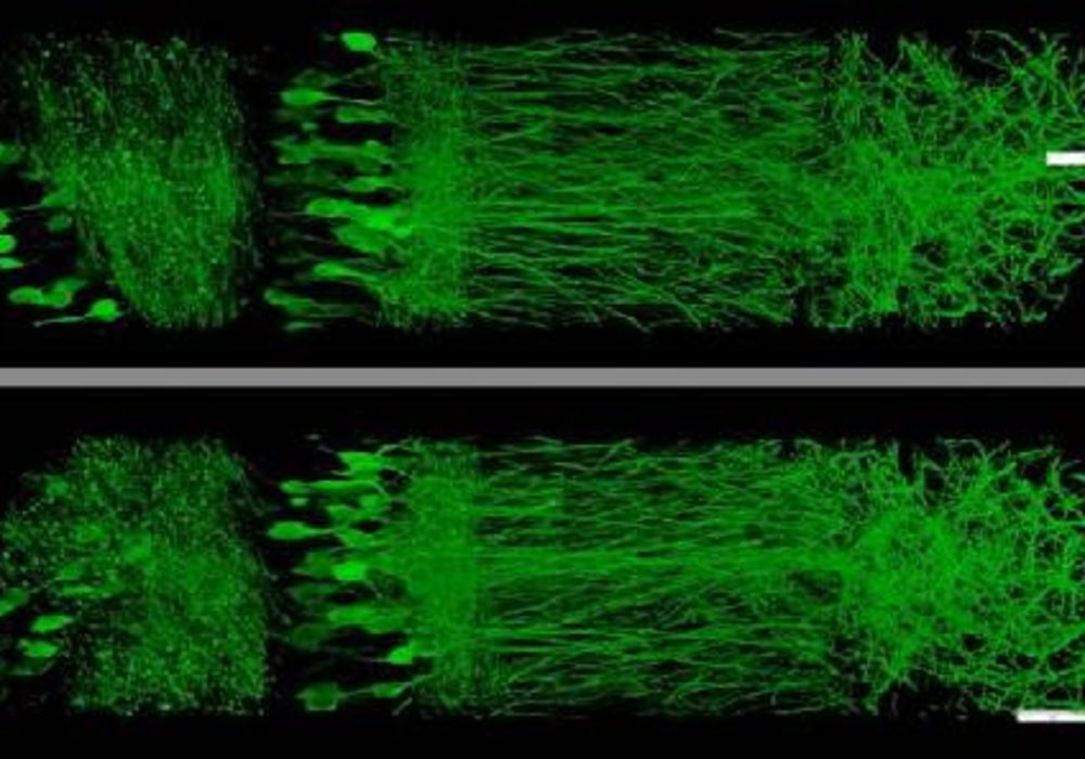 New Method Enlarges Tissue Samples, Enabling High-Res Imaging