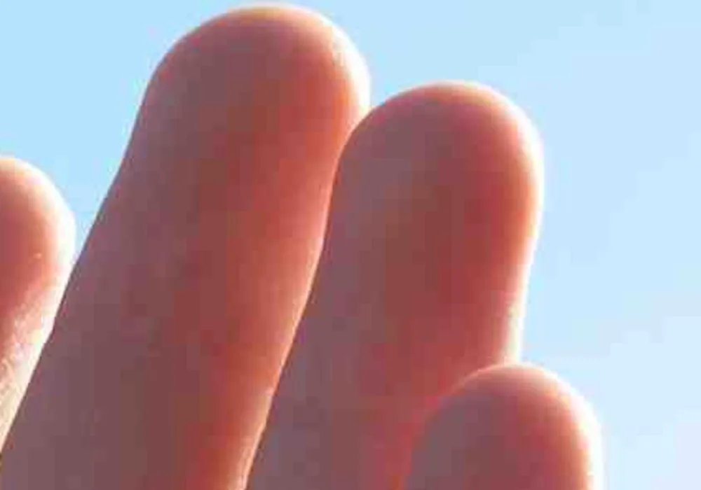 Fingertip Blood Sensor Can be Used for Trauma Patients 