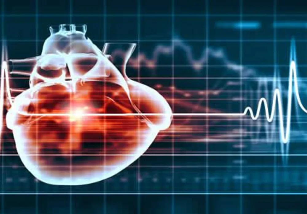 New Software Could Predict Sudden Cardiac Death