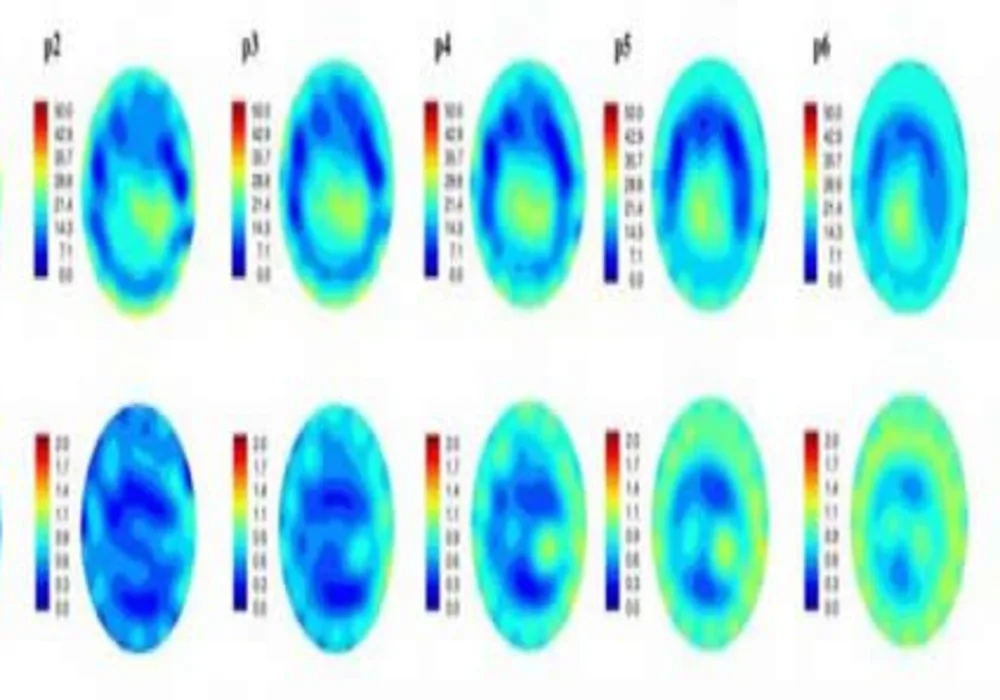 Microwave Imaging: Better, Safer, Cheaper