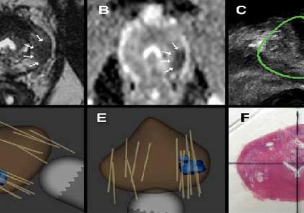 How 3D Printing is Reshaping Medical Practice