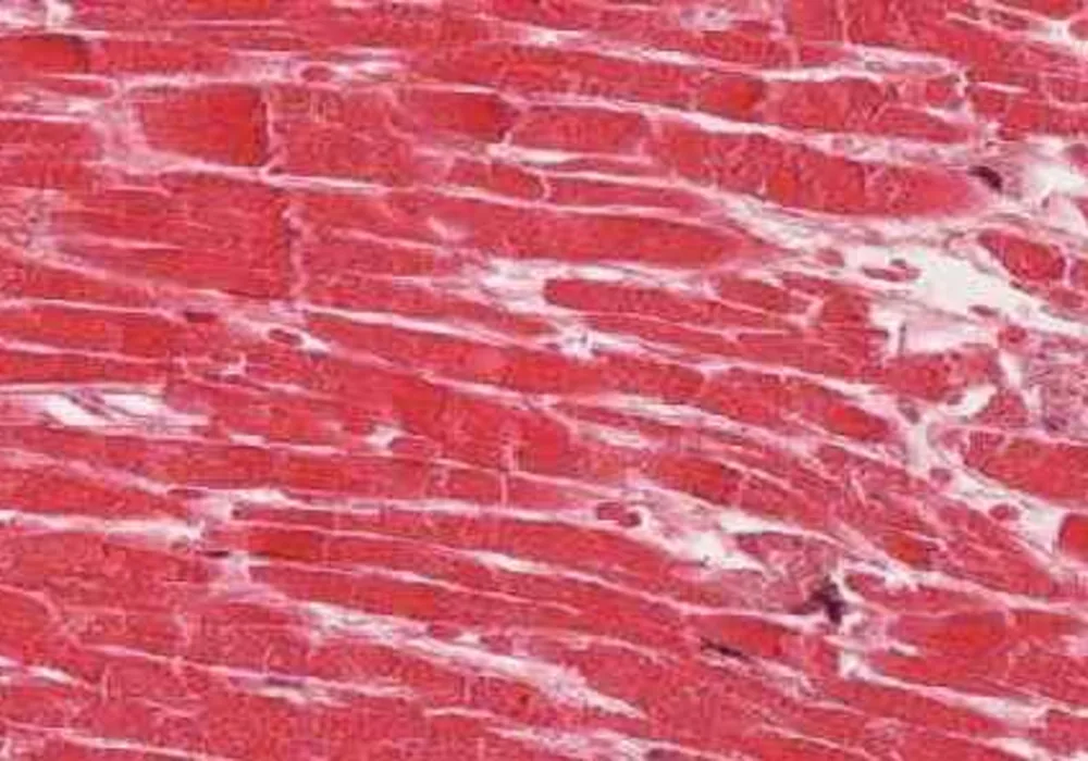 Heart Muscle Inflammation Peaks Twice after MI