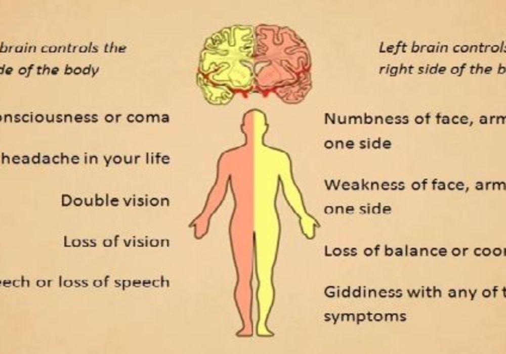 Coping with Pre-Hospital Stroke Symptoms