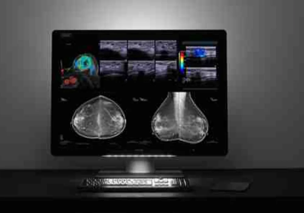 Barco Launches Breast Imaging and PACS Display  