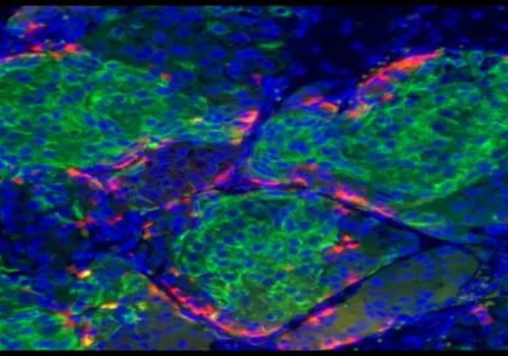 Insulin-Control Cells Produced in Laboratory 