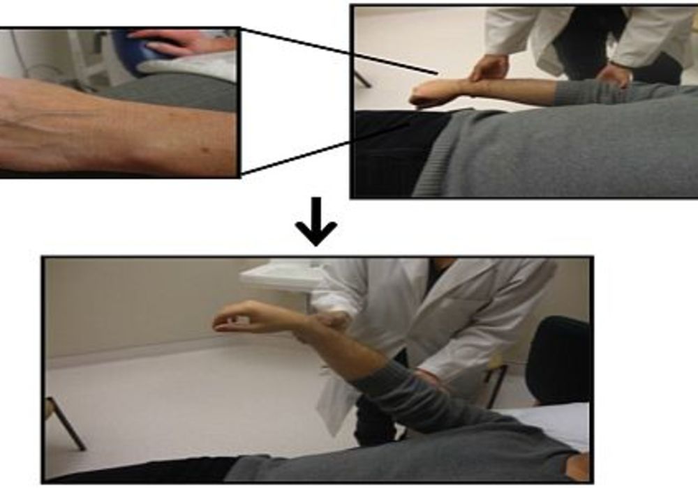 Techniques for Noninvasive CVP Evaluation 