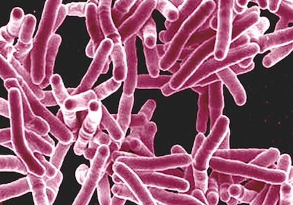 &#039;Genetic Barcode&#039; for Identifying TB Strains