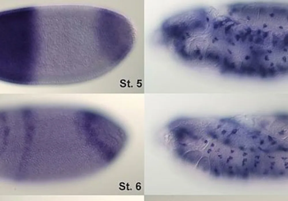 Radiogenomic Imaging Could Replace Biopsy