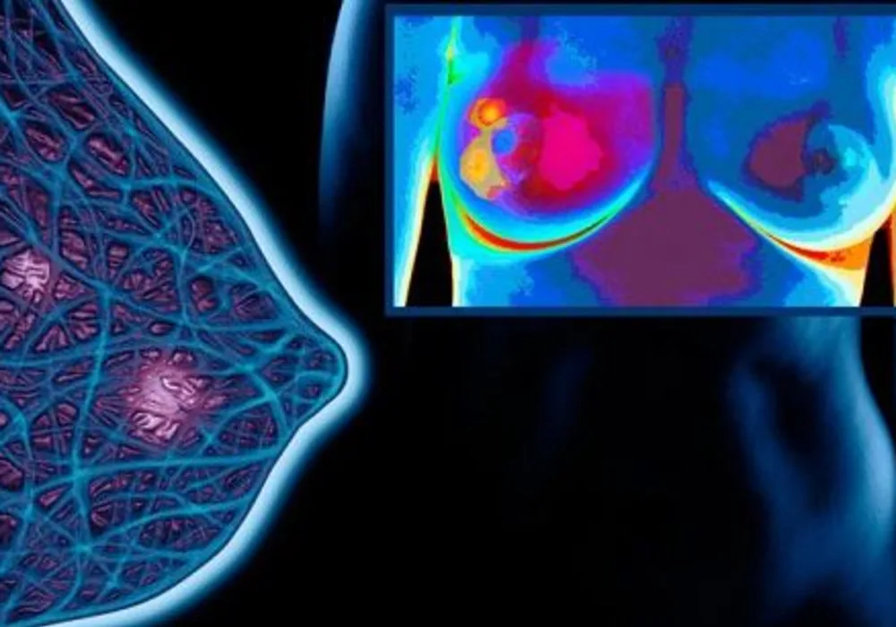 Innovative Breast Imaging Systems