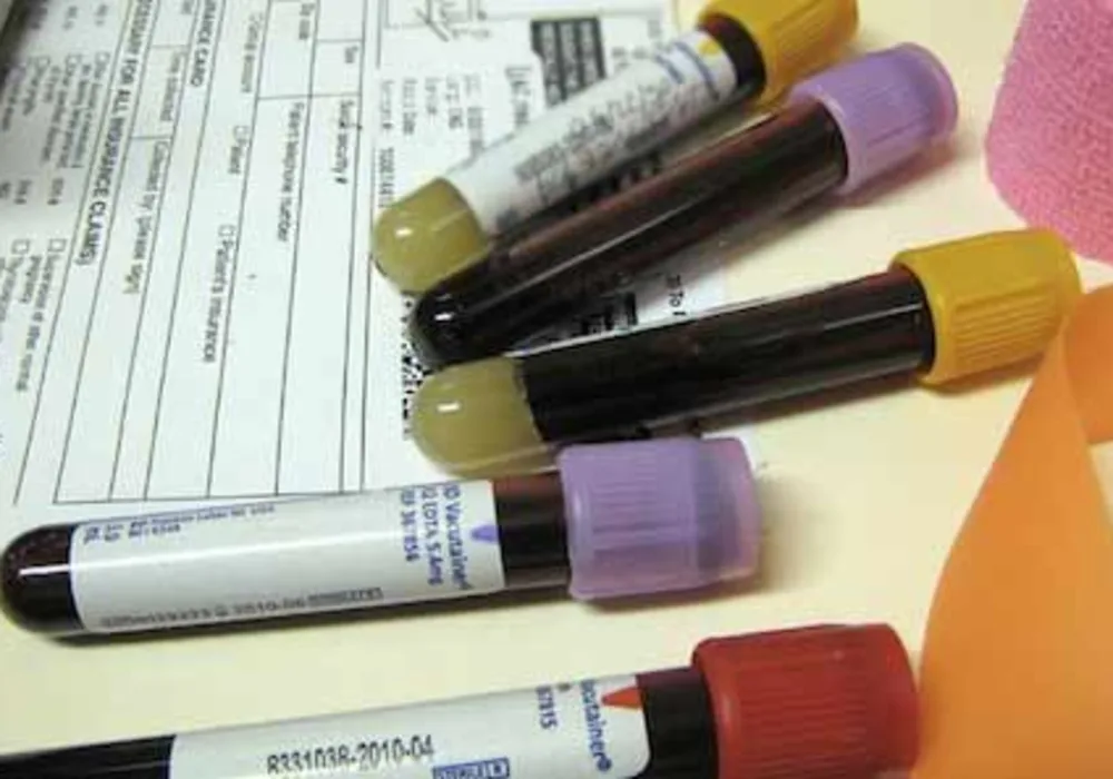 Blood Tests: From $10 to $10,169