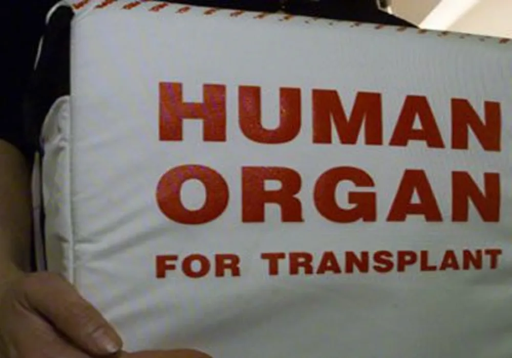 CIT No Barrier to Broader Organ Sharing 