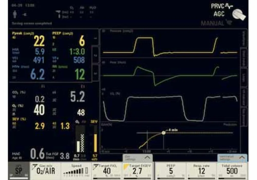 Maquet Critical Care launches AGC, Automatic Gas Control