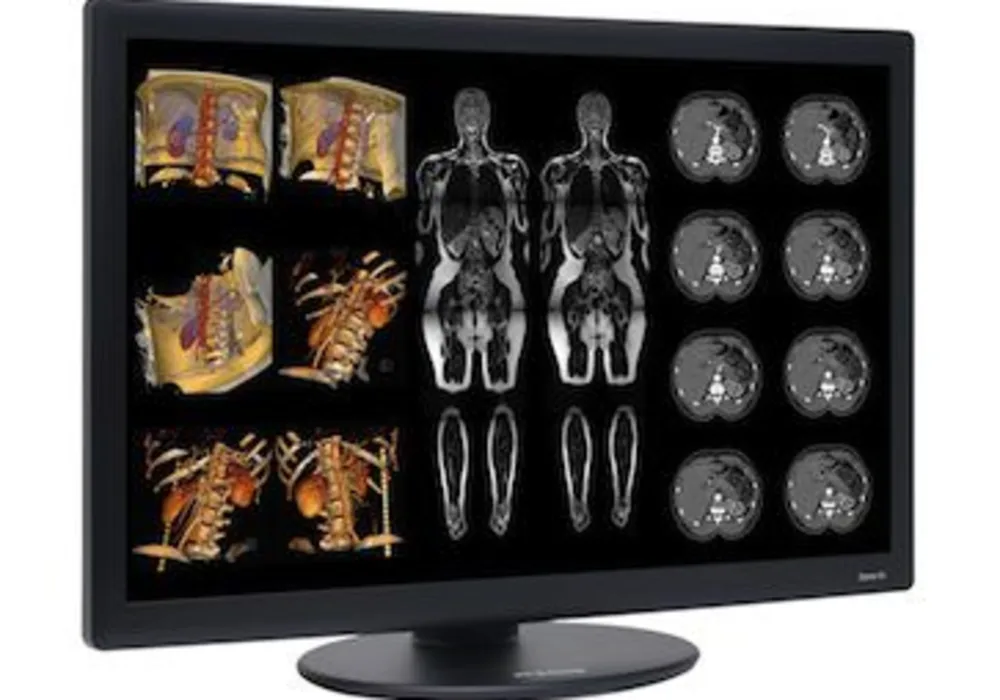 New Benchmark: Dome S6c LED Color Radiology Display Launched