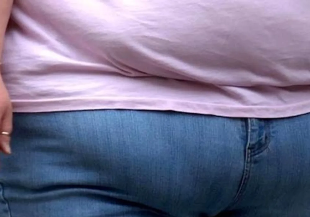 A Heavy Decision: Is Obesity A Disability?