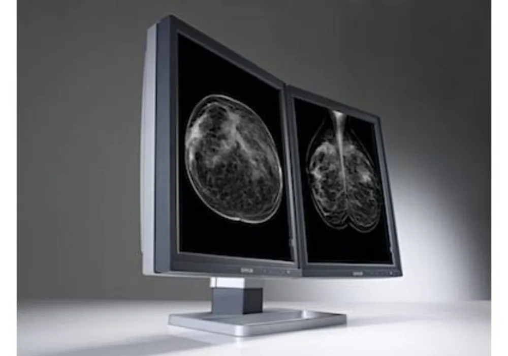 SIIM 2014: Barco Introduces New Image-Enhancing Diagnostic Display System 
