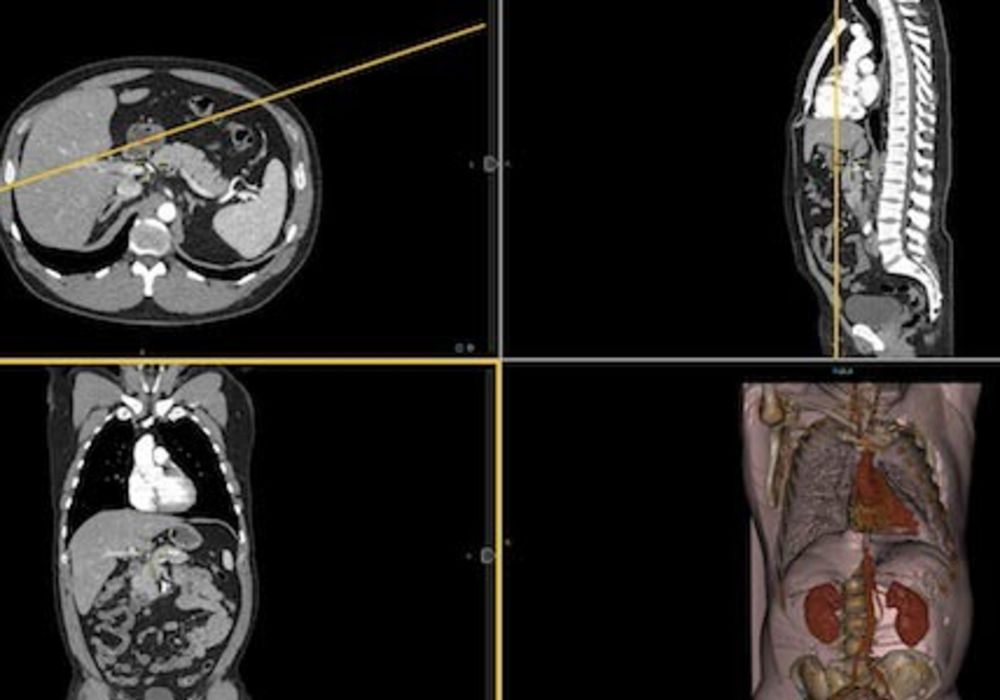 SIIM 2014: Intelerad Launches Diagnostic Tomosynthesis Module 