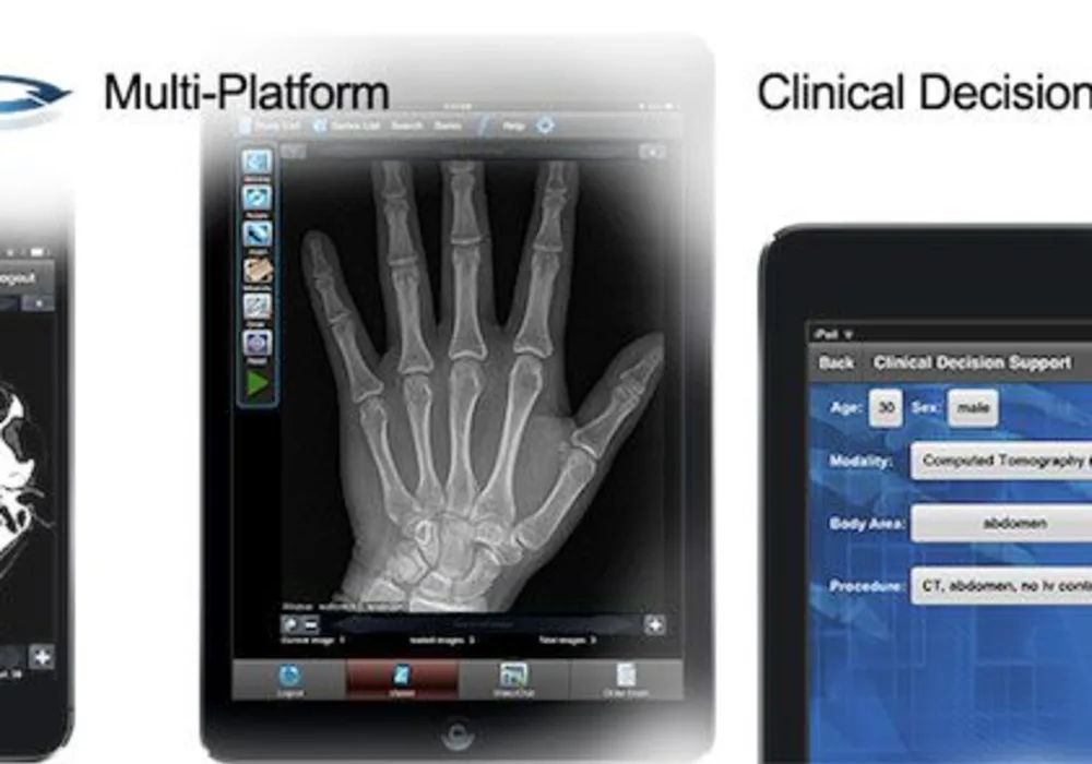 OneDX Unveils Google Glass as Platform for Mobile Access to Health Data 