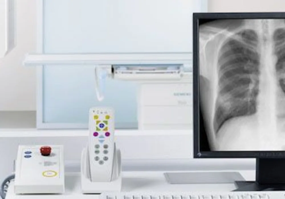 FDA Clearance Given to Siemens&#039; Ysio Max Digital Radiography System