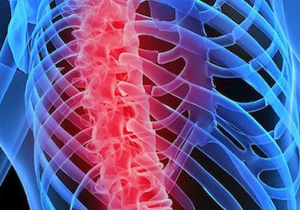 Early Osteoporosis Detection Improved in Finland