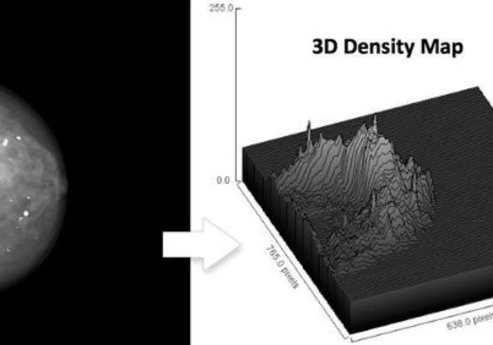 ECR 2014: Volumetric Breast Imaging Provides Data For Screening Dense Breasts