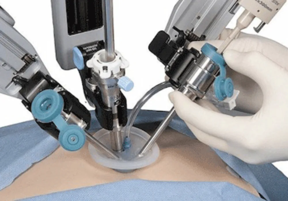 Frost &amp; Sullivan: Increasing Demand for Medical Robots in Surgical Disciplines