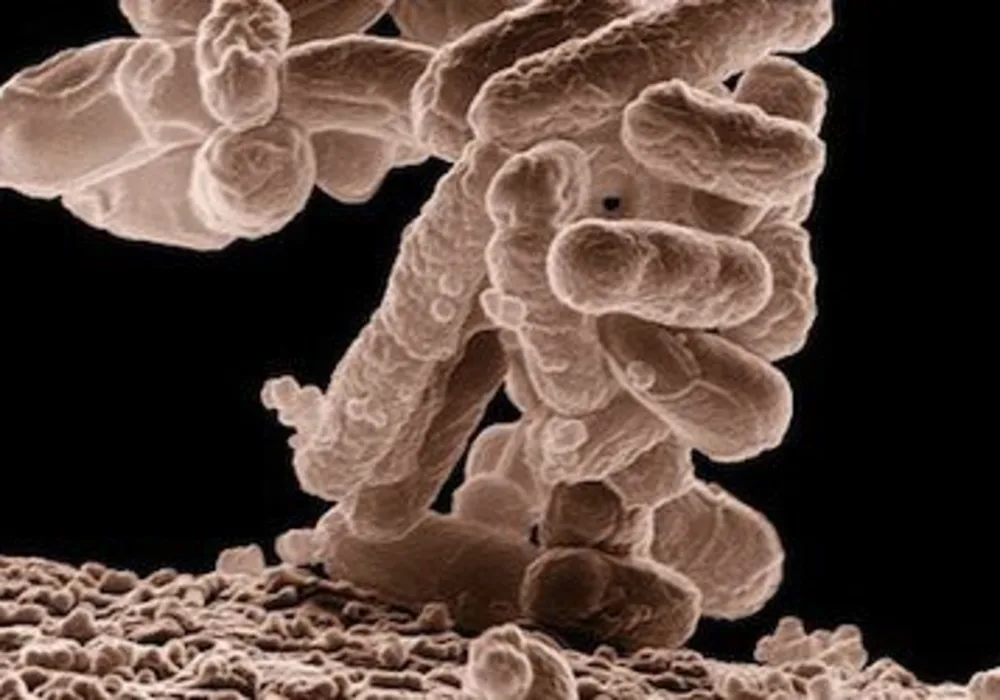 Stubborn Antibiotic-Resistant Bacteria Behaviour Revealed