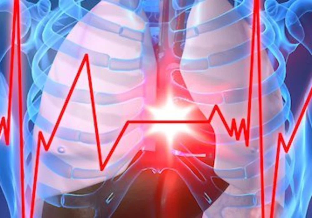 Use of Gender-Specific Chest Pain Symptoms in Early Diagnosis of Heart Attack not Conclusive