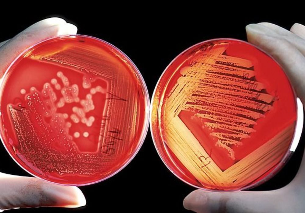 The UK Is Not Investing Enough In Research Into Multi-Drug Resistant Infections, Say Researchers