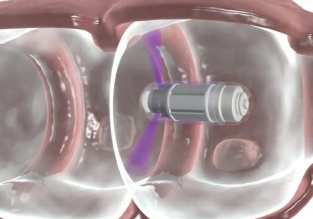 Colon Imaging of the Future: Swallow a Capsule 