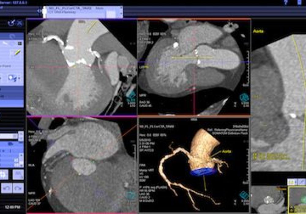 See more, Work More Efficiently: Siemens Solutions for Cardiology