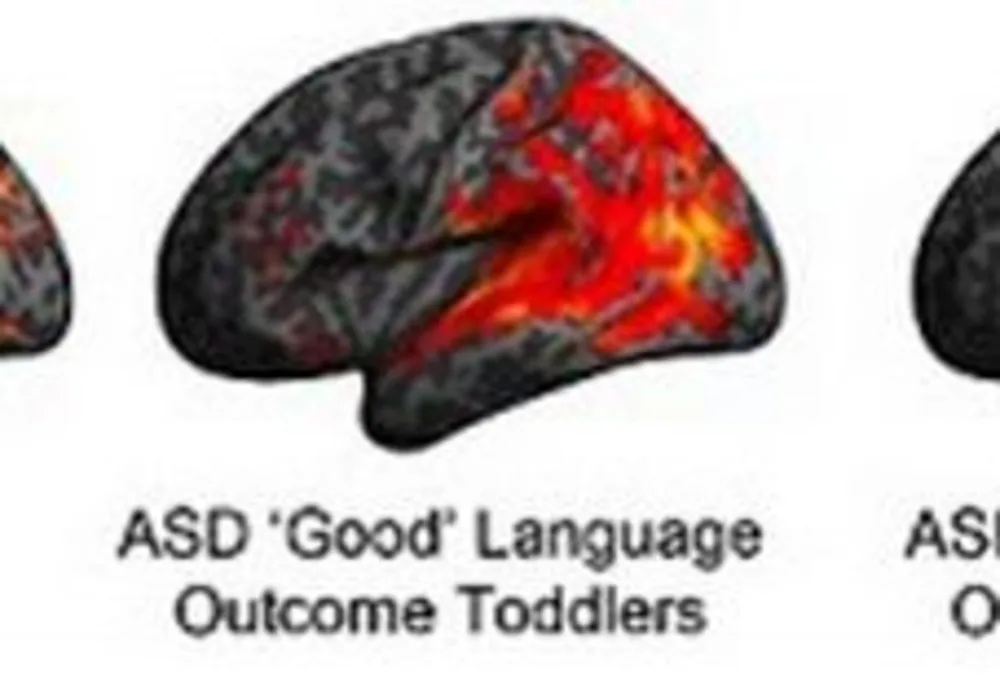 Brain Imaging Predicts Language Ability in ASD Toddlers