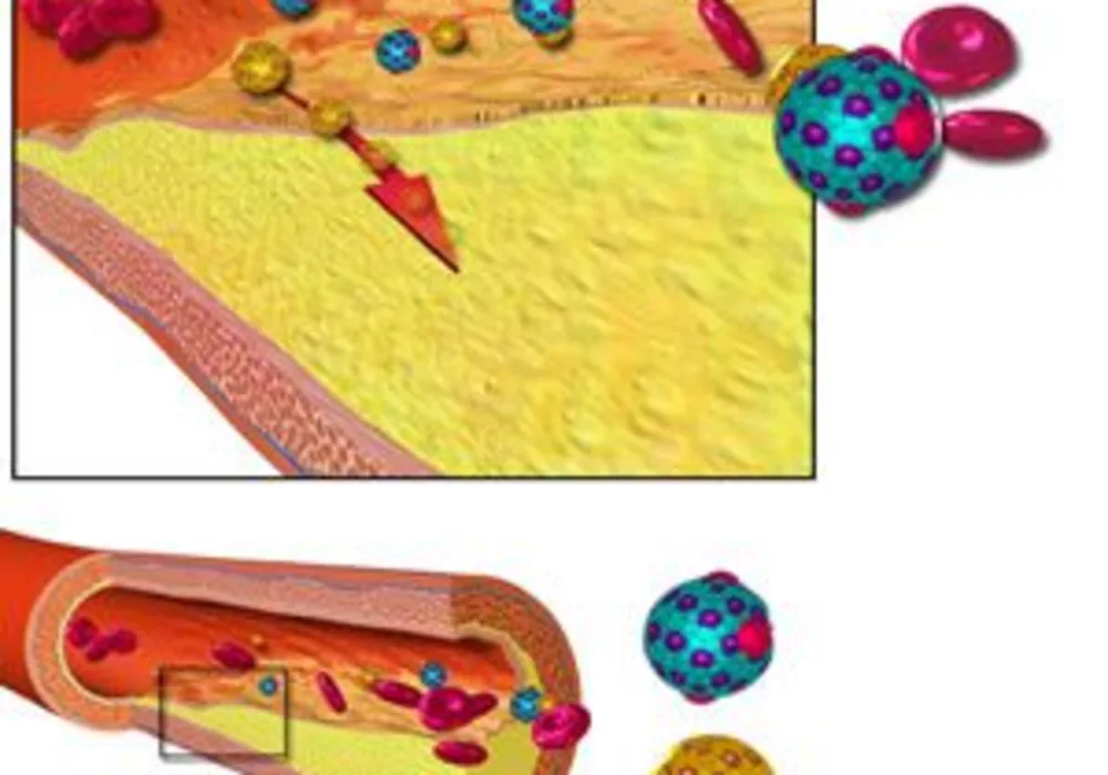 Paediatric Cholesterol Guidelines for Young Adults Increase Statin Use