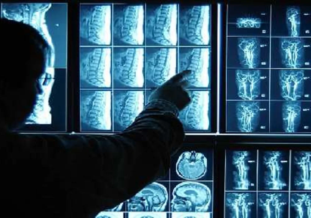Is Early Imaging for Back Pain in Older Adults Necessary?