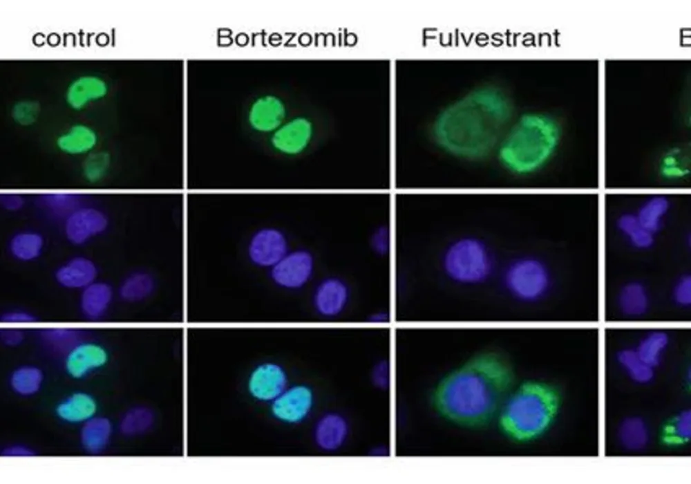 Drug Combination Delays Progression of Breast Cancer