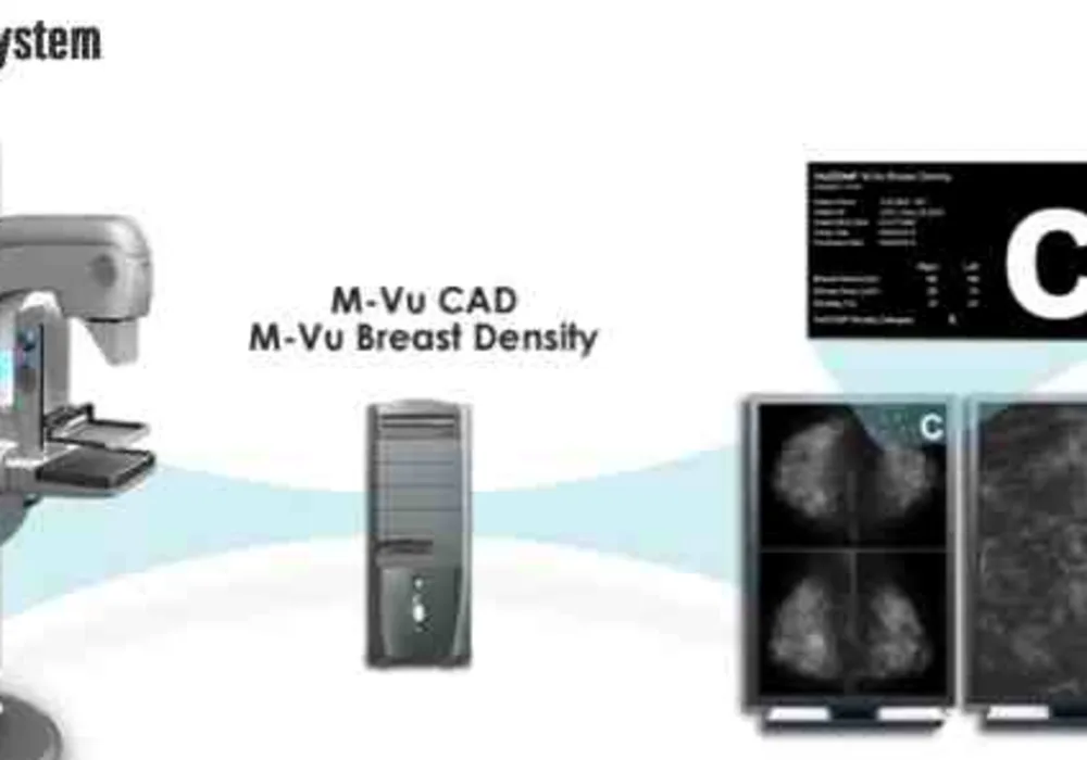 RSNA 2014: VuCOMP Showcases Industry-Leading Computer Vision Systems for Breast Cancer Detection