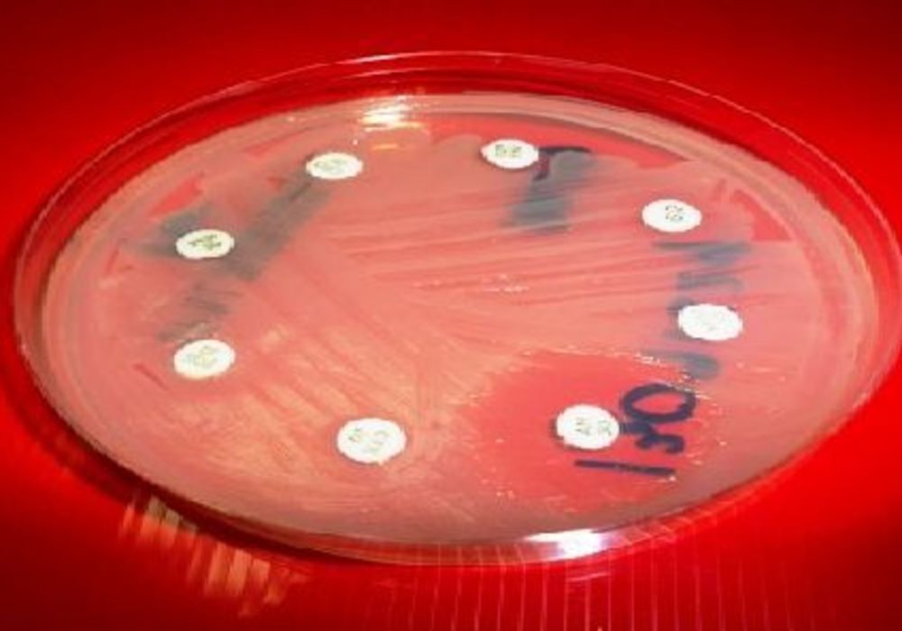 New Method Detects Antibiotic Resistance Fast