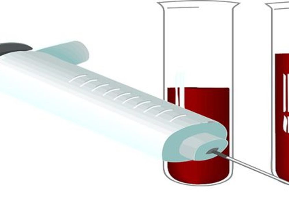 Single Blood Test To Screen For Different Types Of Cancer