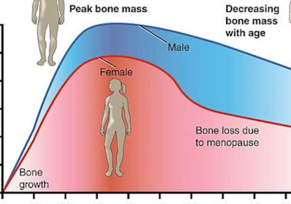 Bone Loss Drug Passes Trial; Side Effects Linger