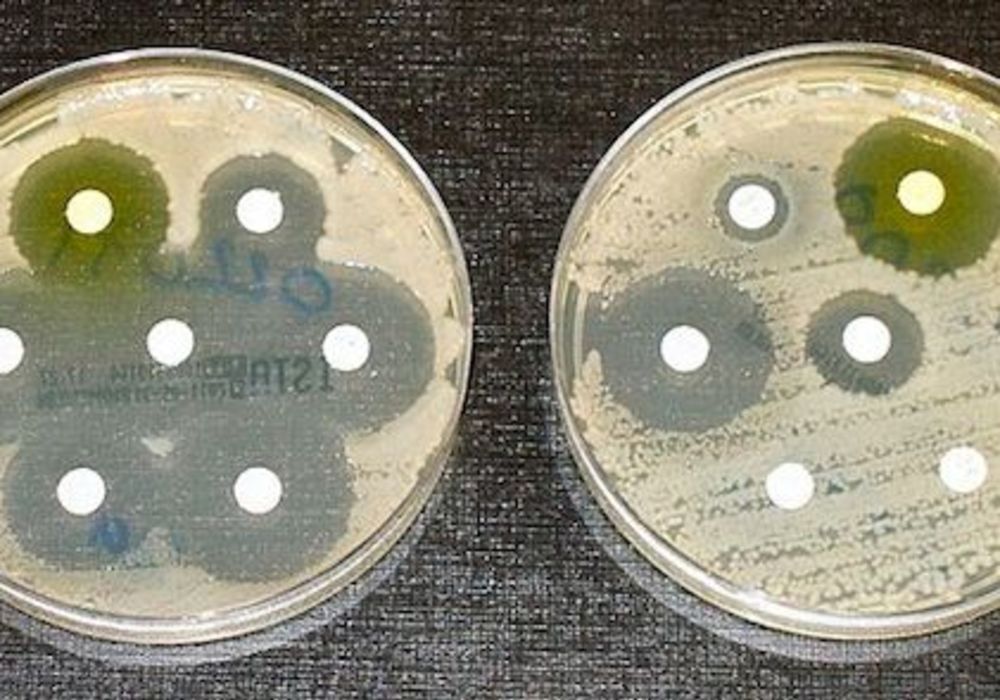 Lab Test IDs Superbugs in Hours