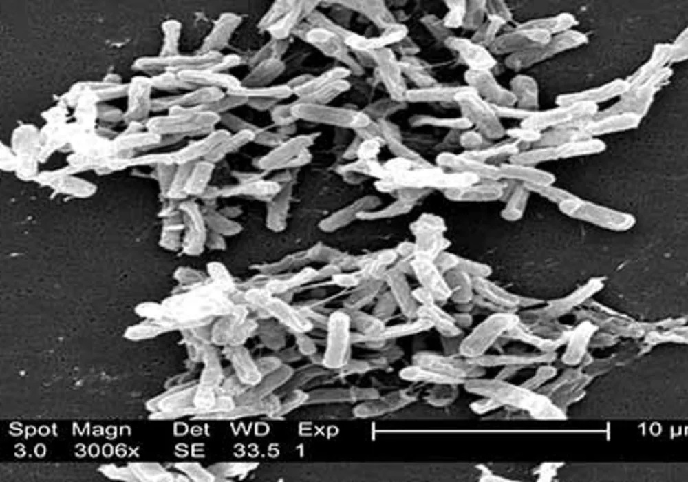 DNA Vaccine For C. Difficile