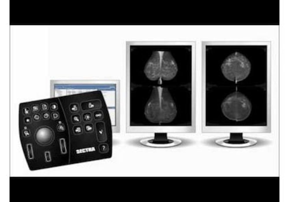 Northern Ireland Expands Sectra PACS Contract to Include Digital Breast Imaging