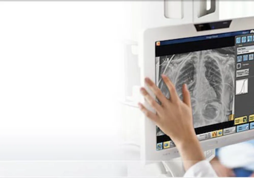 FDA Approval For Carestream&rsquo;s New Bone Suppression Software 