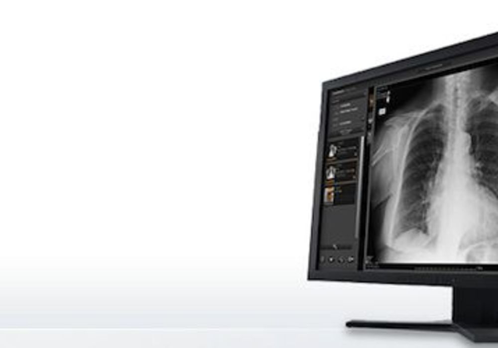 Carestream&rsquo;s Newest Mini-PACS Software Improves DR Imaging Systems    