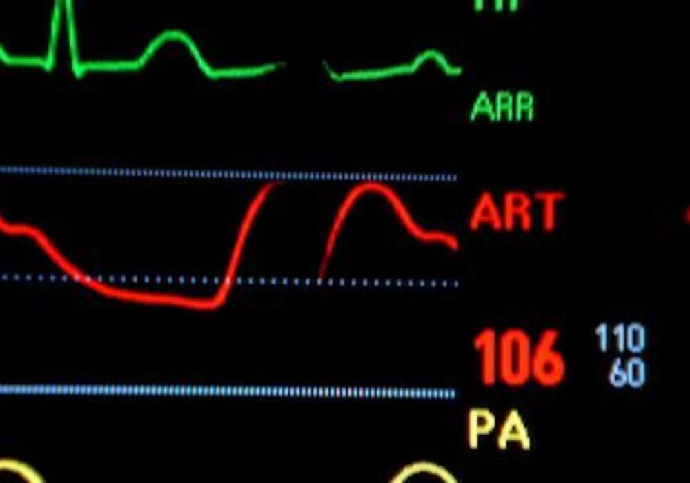 New Scan Identifies Heart Attack Risk