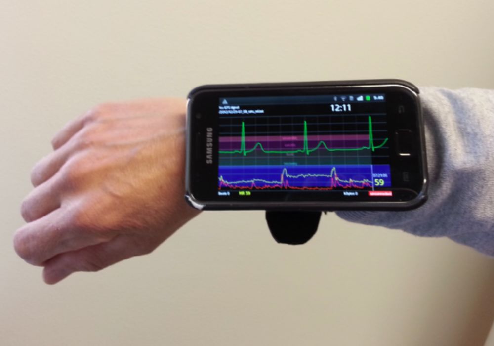 ECG into Your Mobile