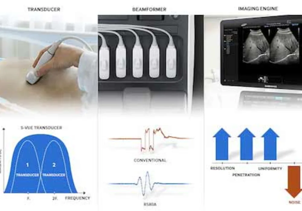 Samsung Introduces RS80A Premium Ultrasound System