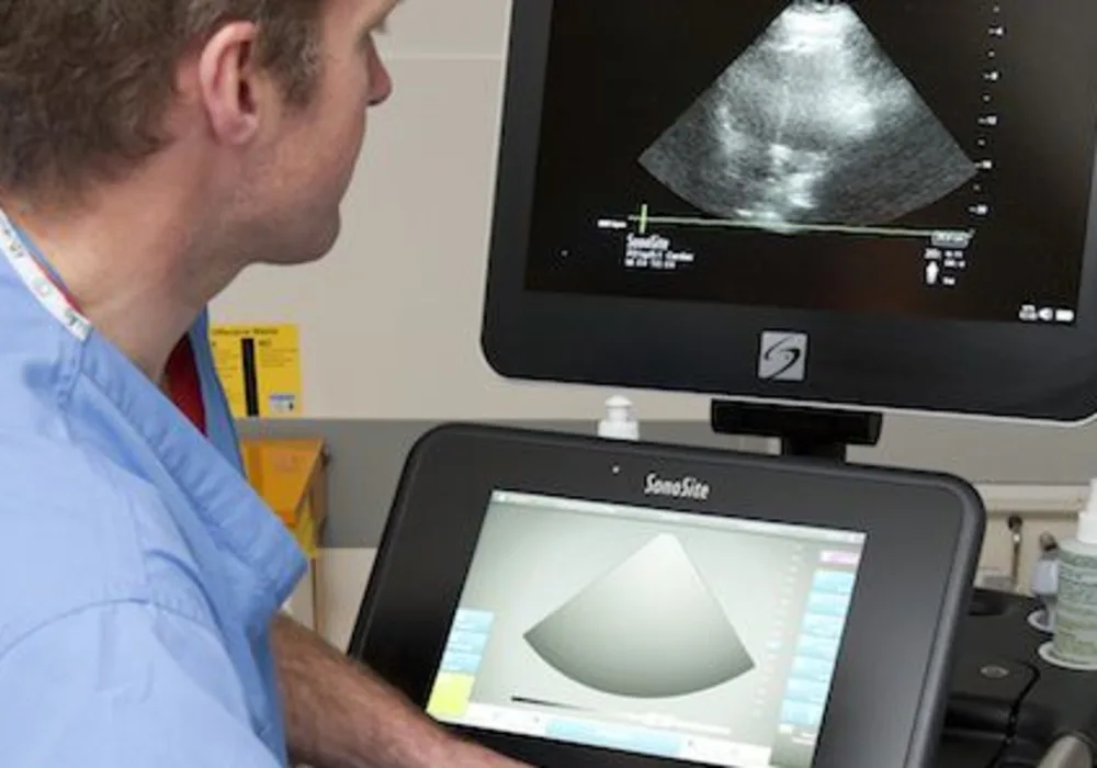 Ultrasound in Critical Care Courses Use SonoSite Systems